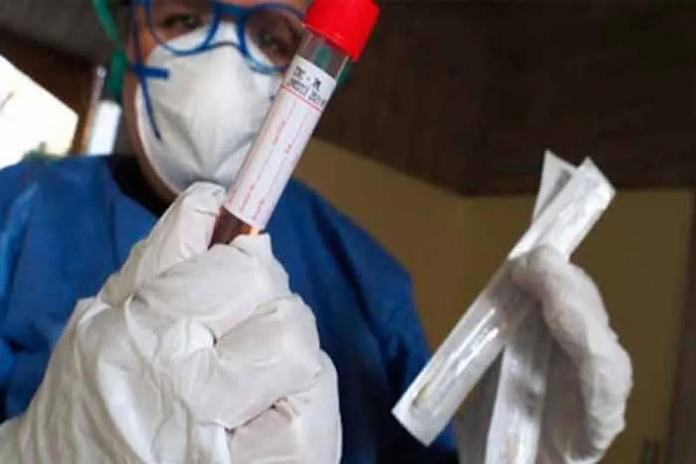 En doce horas se obtuvieron resultados de estudios del coronavirus