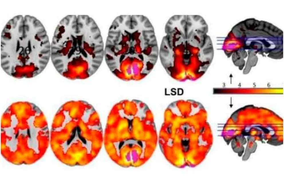 Un estudio reveló que la droga alucinógena comúnmente conocida como LSD (dietilamida de ácido lisérgico) permite que el cerebro se ‘libere’ de las divisiones dictadas por la anatomía, revela Science Alert.