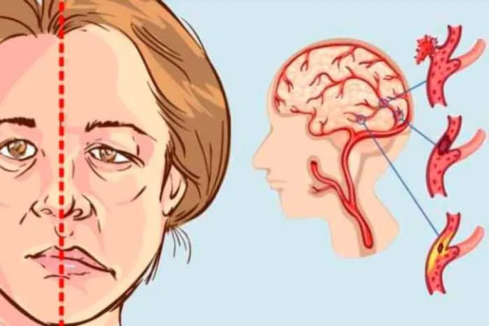 Hay que estar atentos a cualquier síntoma