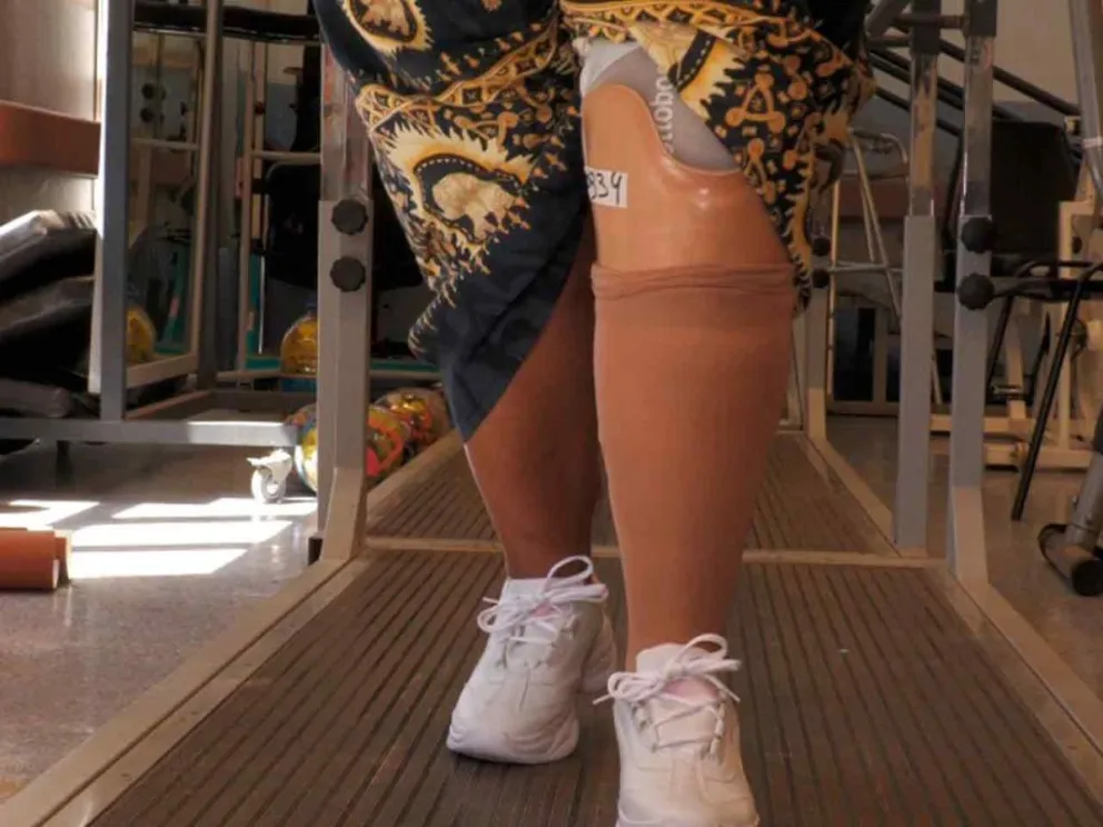 Entregan en promedio 13 prótesis mensuales 