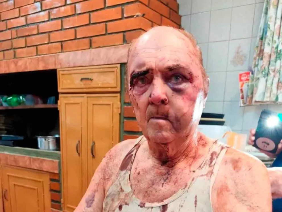 La víctima sufrió severas lesiones en el rostro