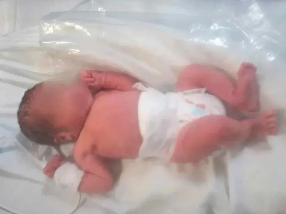 Está en Terapia Intensiva