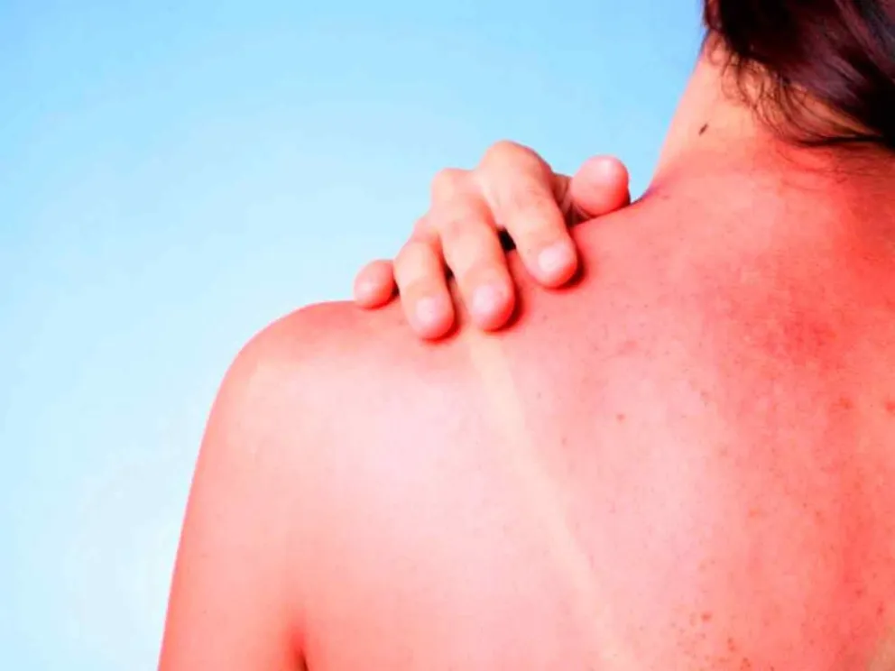 Apuntando a la prevención