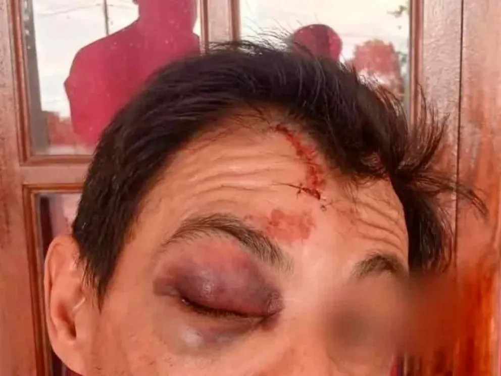 La víctima sufrió graves lesiones en el rostro