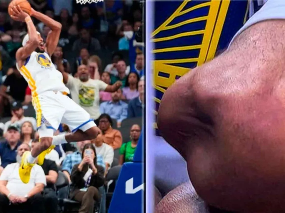 Moody se lesionó la rodilla izquierda