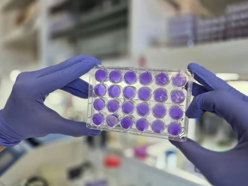 Nuevo hallazgo del Conicet Todos los virus del género Orthoflavivirus, peligrosos para los humanos, comparten una pieza esencial dentro del mecanismo que utilizan para multiplicarse en la célula.
