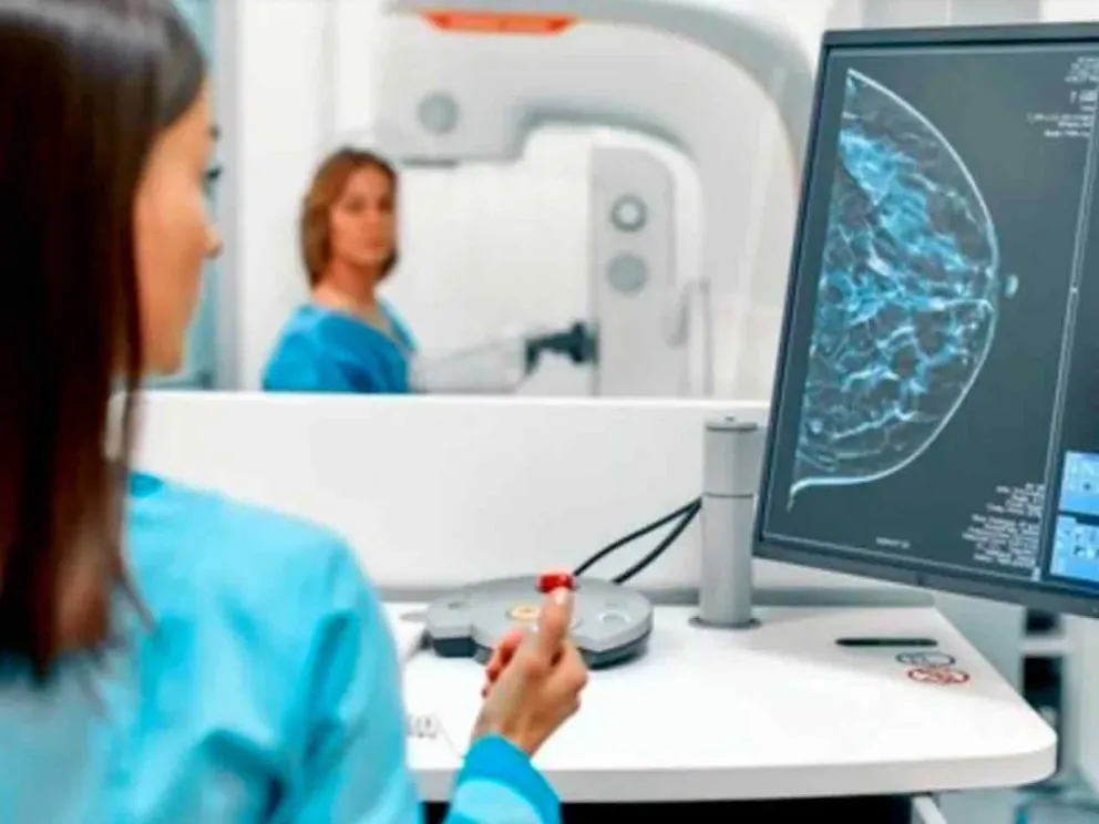 Para controles preventivos del cáncer de mama